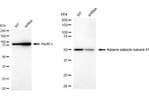 anti-Katanin P60 (ATPase Containing) Subunit A 1 (KATNA1) antibody