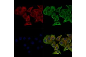 Phospho-p23 (Ser113) Antibody staining Hela cells(heat shock treatment) by IF/ICC.