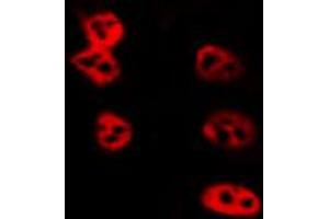 ABIN6274017 staining LOVO by IF/ICC.