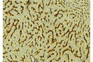 ABIN6276620 at 1/100 staining Mouse liver tissue by IHC-P.