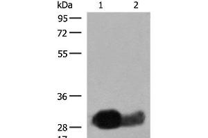 Western blot analysis of Raji cell Human spleen tissue lysates using HLA-DRB1 Polyclonal Antibody at dilution of 1:550 (HLA-DRB1 anticorps)