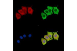 GK5 Antibody staining Hela cells by IF/ICC. (GK5 anticorps)