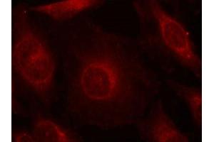 Immunofluorescence staining of methanol-fixed Hela cells using AKT1/AKT2/AKT3(phospho-Tyr315/316/312) Antibody. (AKT 1/2/3 anticorps  (pTyr312, pTyr315, pTyr316))