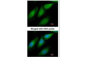 ICC/IF Image Immunofluorescence analysis of paraformaldehyde-fixed HeLa, using SUGT1, antibody at 1:200 dilution.