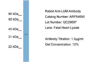 WB Suggested Anti-LUM  Antibody Titration: 0.