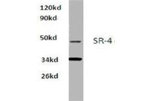 Western blot analysis of SR-4 Antibody  in extracts from Hela cells at 1/500 dilution. (Serotonin Receptor 4 anticorps)