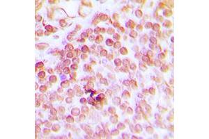 Immunohistochemical analysis of ERCC1 staining in human tonsil formalin fixed paraffin embedded tissue section.
