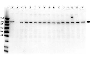 Western Blot of Rabbit anti-PARP1 antibody multi lysate Western Blot of Rabbit anti-PARP1 N-term Antibody. (PARP1 (ZF1) (N-Term) anticorps)