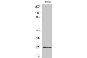 Western Blotting (WB) image for anti-RAB, Member of RAS Oncogene Family-Like 2A (RABL2A) (C-Term) antibody (ABIN3186633) (RABL2A anticorps  (C-Term))