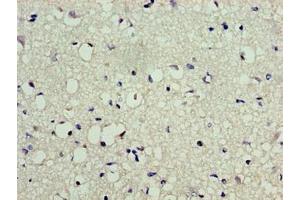 Immunohistochemistry of paraffin-embedded human brain tissue using ABIN7174208 at dilution of 1:100 (LSM1 anticorps  (AA 1-123))
