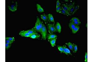 Immunofluorescent analysis of HepG2 cells using ABIN7158346 at dilution of 1:100 and Alexa Fluor 488-congugated AffiniPure Goat Anti-Rabbit IgG(H+L) (LIMS3 anticorps  (AA 1-117))