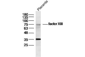 Mouse placenta lysates probed with factor XIII Polyclonal Antibody, Unconjugated  at 1:300 dilution and 4˚C overnight incubation.