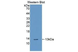 Detection of Recombinant PLXNB1, Human using Polyclonal Antibody to Plexin B1 (PLXNB1) (PLXNB1 anticorps  (AA 200-727))