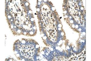 Complement C8b antibody was used for immunohistochemistry at a concentration of 4-8 ug/ml. (C8B anticorps  (Middle Region))
