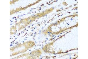 Immunohistochemistry of paraffin-embedded Human stomach using UBE2L3 Polyclonal Antibody at dilution of 1:100 (40x lens). (UBE2L3 anticorps)