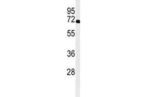 Western blot analysis of XRCC6 antibody and A2058 lysate.
