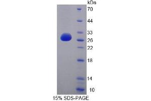 SDS-PAGE analysis of Human LYPLA1 Protein. (LYPLA1 Protéine)