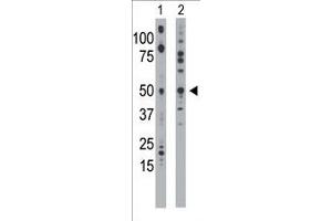 The anti-EKI1 Pab (ABIN391086 and ABIN2841227) is used in Western blot to detect EKI1 in mouse bladder tissue lysate (Lane 1) and 293 cell lysate (Lane 2).