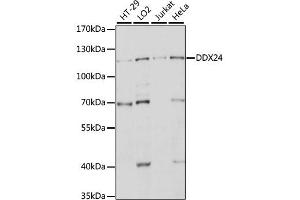 Western blot analysis of extracts of various cell lines, using DDX24 antibody (ABIN6291995) at 1:1000 dilution.