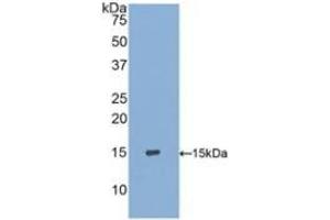Detection of Recombinant S100A9, Human using Polyclonal Antibody to S100 Calcium Binding Protein A9 (S100A9) (S100A9 anticorps  (AA 1-114))
