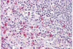 Anti-NFAT5 antibody IHC staining of human spleen. (NFAT5 anticorps  (AA 1171-1220))