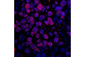 anti-serine/arginine-Rich Splicing Factor 10 (SRSF10) (AA 133-183) antibody