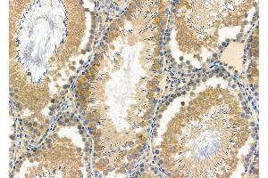 ABIN6261885 and ABIN6277125 at 1/100 staining Rat testis tissue by IHC-P. (GAS2L1 anticorps  (C-Term))