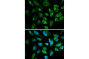 Immunofluorescence analysis of HepG2 cells using KIR2DL3 antibody (ABIN3212244). (KIR2DL3 anticorps)
