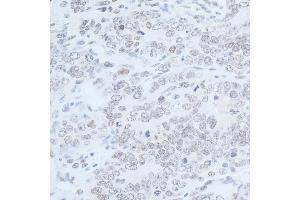 Immunohistochemistry (IHC) image for anti-Rad6 (N-Term) antibody (ABIN7449403) (Rad6 (N-Term) anticorps)