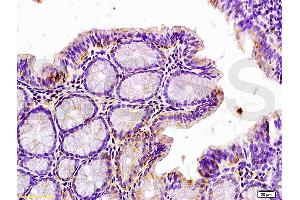 Formalin-fixed and paraffin embedded rat colitis tissue labeled with Anti-Phospho-IRAK1 (Thr209) Polyclonal Antibody, Unconjugated (ABIN742658) at 1:200 followed by conjugation to the secondary antibody and DAB staining