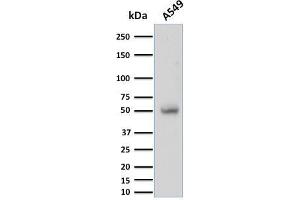 Western Blot Analysis of A549 cell lysate using CD14 Mouse Monoclonal Antibody (LPSR/2397).
