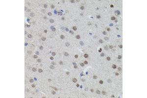 Immunohistochemistry of paraffin-embedded mouse brain using MYCN antibody. (MYCN anticorps)