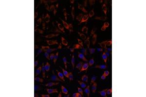 Immunofluorescence analysis of L929 cells using STIM2 antibody (ABIN7270611) at dilution of 1:100.