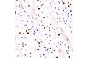 Immunohistochemistry of paraffin-embedded human vermiform appendix using GEMIN2 Antibody. (SIP1 anticorps)