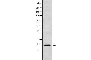 Western blot analysis of MRPL30 using HeLa whole cell lysates (MRPL30 anticorps  (Internal Region))