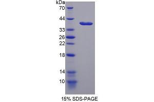 Image no. 1 for Nestin (NES) (AA 197-462) protein (His tag) (ABIN4988445)