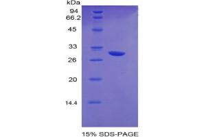 SDS-PAGE analysis of Mouse EGR2 Protein. (EGR2 Protéine)