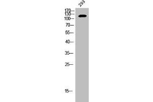 Western Blot analysis of 293 cells using EphB2 Polyclonal Antibody (EPH Receptor B2 anticorps  (C-Term))