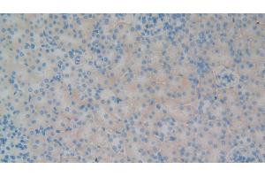 Detection of GP1BB in Rat Kidney Tissue using Polyclonal Antibody to Platelet Glycoprotein Ib Beta Chain (GP1BB) (GP1BB anticorps  (AA 52-164))