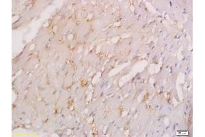 Formalin-fixed and paraffin embedded rabbit myocardium labeled with Anti-BECN1/Beclin 1/ATG6 Polyclonal Antibody, Unconjugated (ABIN675384) followed by conjugation to the secondary antibody and DAB staining