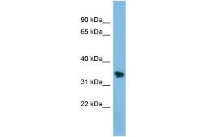 WB Suggested Anti-NSMCE1 Antibody Titration: 0. (NSMCE1 anticorps  (Middle Region))