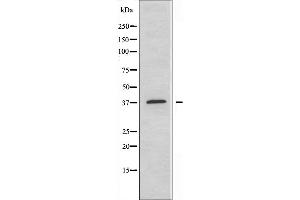 Western blot analysis of extracts from HT-29 cells, using MEF2B antibody. (MEF2B anticorps  (Internal Region))