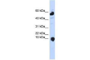WB Suggested Anti-C1orf151 Antibody Titration:  0. (C1orf151 anticorps  (Middle Region))