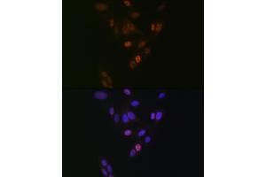 Immunofluorescence analysis of U-2 OS cells using NUP153 Rabbit mAb (ABIN1512527, ABIN3023298, ABIN3023299 and ABIN7101477) at dilution of 1:100 (40x lens).