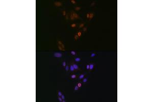 Immunofluorescence analysis of U-2 OS cells using NUP153 Rabbit mAb (ABIN1512527, ABIN3023298, ABIN3023299 and ABIN7101477) at dilution of 1:100 (40x lens). (NUP153 anticorps)