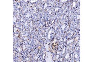 IHC analysis of SH3GL2 using anti-SH3GL2 antibody (ABIN7602229). (SH3G2 anticorps  (AA 65-292))