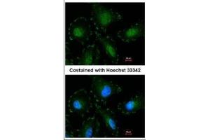 ICC/IF Image Immunofluorescence analysis of paraformaldehyde-fixed HeLa, using Calpain-5, antibody at 1:100 dilution. (Calpain 5 anticorps)