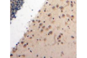 Used in DAB staining on fromalin fixed paraffin-embedded Brain tissue (ATR anticorps  (AA 2353-2644))