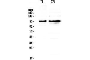 Western blot analysis of PSD95 using anti- PSD95 antibody .