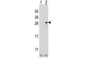 Western blot analysis of FGF9 (arrow) using rabbit polyclonal FGF9 Antibody (N-term) .